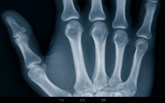 xray scanner apps android 1