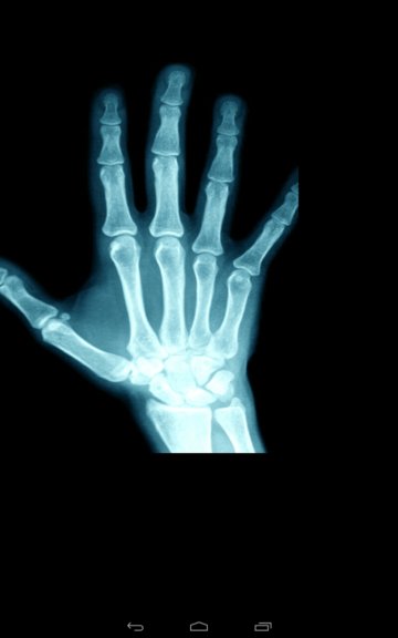 xray scanner apps android 3