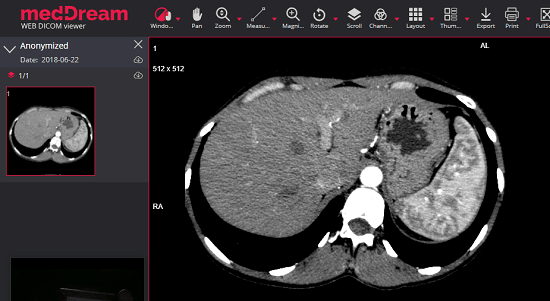 DICOM Library free DCM viewer online