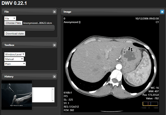 Dicom Web Viewer or DWV in action