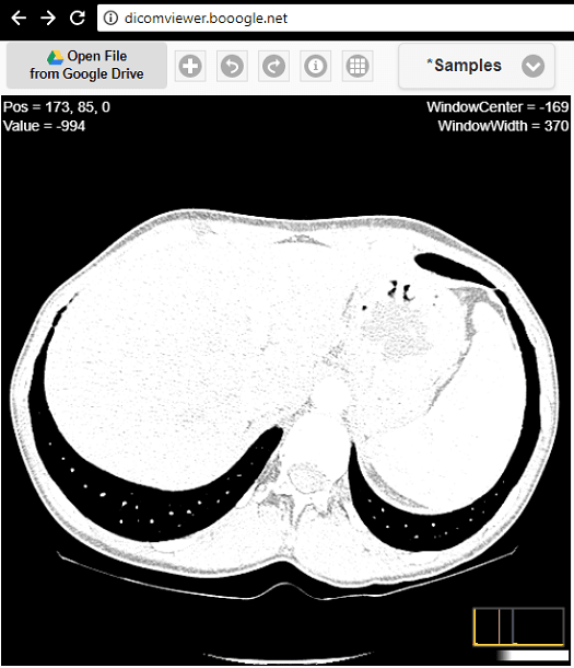 Dicom viewer in action