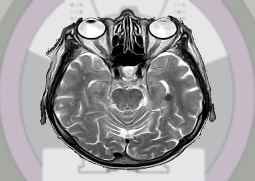 Free Online Dicom Viewer Websites to Open and View DCM Files