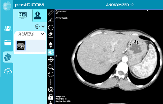 postDICOM free online DCM viewer