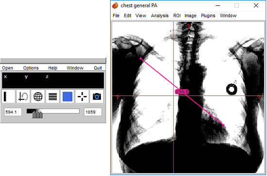 3DimViewer free x-ray viewer software