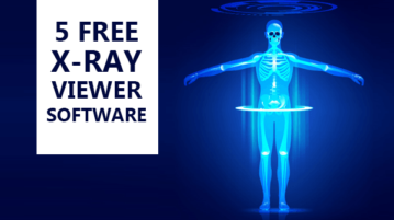 Free X-Ray Viewer Software for Windows
