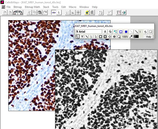 Free Software to Analyse Immunocytochemistry Images Cells&Maps