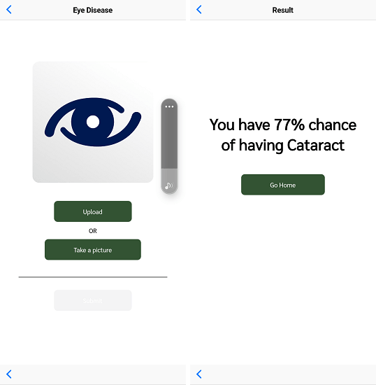 VisionCare Eye Disease Results